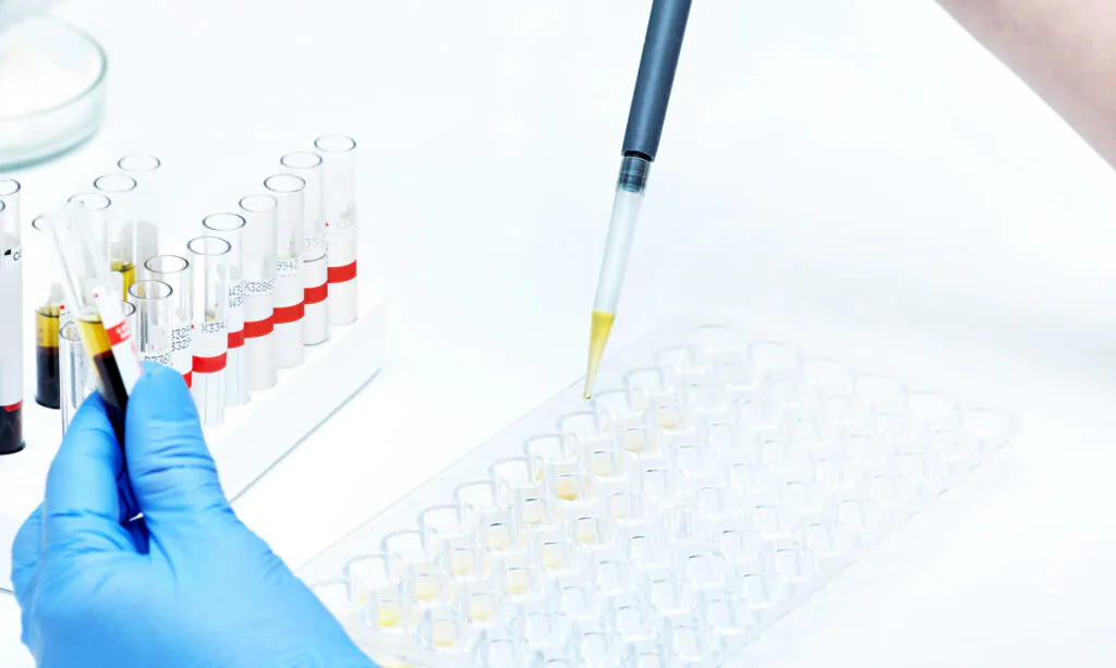 Redox Innovation Protein Carbonyl Assay Test